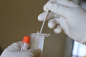 लखनऊ न्यूज़: प्रदेश में कल 1,66,285 सैम्पल की जांच की गयी और कोरोना संक्रमण के 2414 नये मामले आये
