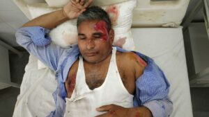 Agra News: अनियंत्रित होकर पलटा टेम्पो एक व्यक्ति हुआ घायल