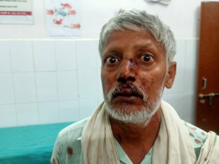 Agra News: खेत पर जा रहे किसान पर दबंगों ने बोला हमला