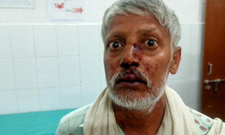 Agra News: खेत पर जा रहे किसान पर दबंगों ने बोला हमला