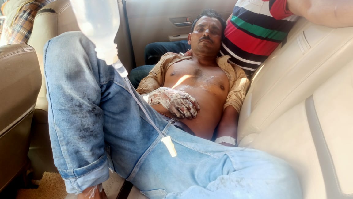 Agra News: विद्युत लाइन सही कर रहा लाइनमैन करंट के झटके से गिरा नीचे