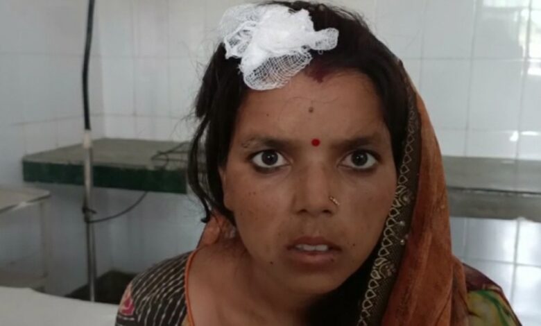 Agra News:दबंगो ने की महिला के साथ जमकर मारपीट