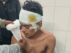 Bihar News-मजदूरी मांगने वाले मजदूर को मारपीट कर किया घायल