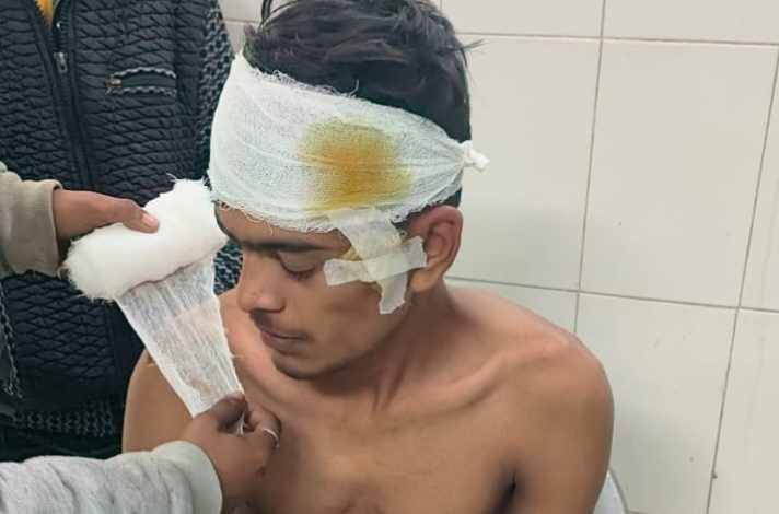 Bihar News-मजदूरी मांगने वाले मजदूर को मारपीट कर किया घायल