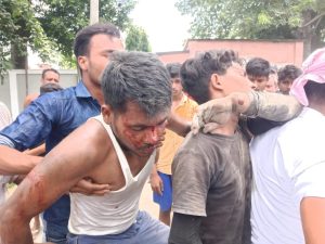 Bihar News मझौलिया में गैस टैंकर फटने से एक के चिथड़े उड़े, जबकि दो लोग बुरी तरह घायल 