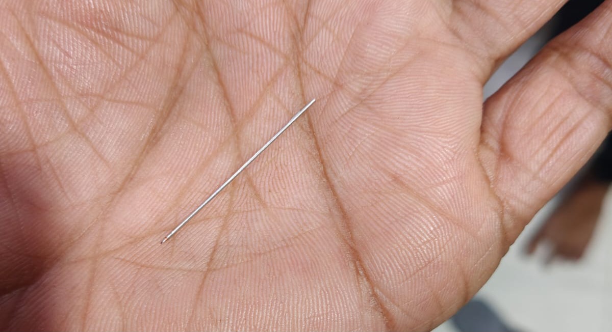 IMG 20260406 WA0020 राजापाकर CHC में नवजात के साथ लापरवाही का मामला