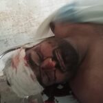 Agra News :बेतिया में पुलिस हिरासत में दिलशाद मियां की संदिग्ध मौत, परिजनों ने मांगी उच्चस्तरीय जांच